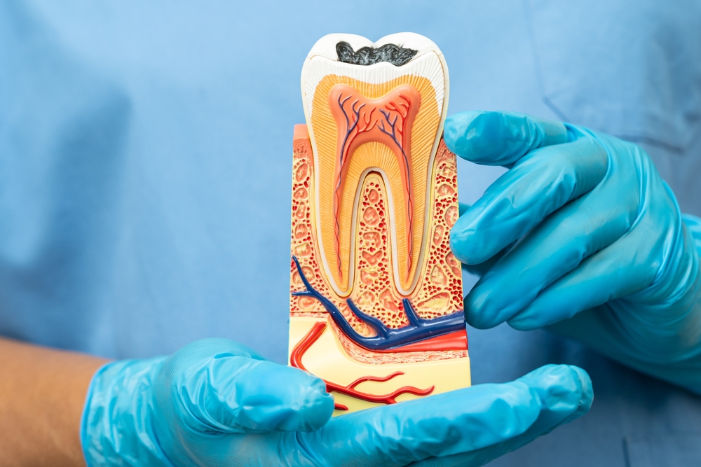 A dentist holds a dental implant, demonstrating artificial tooth roots, relevant for Root canals at Spencer Dental in Maryville
