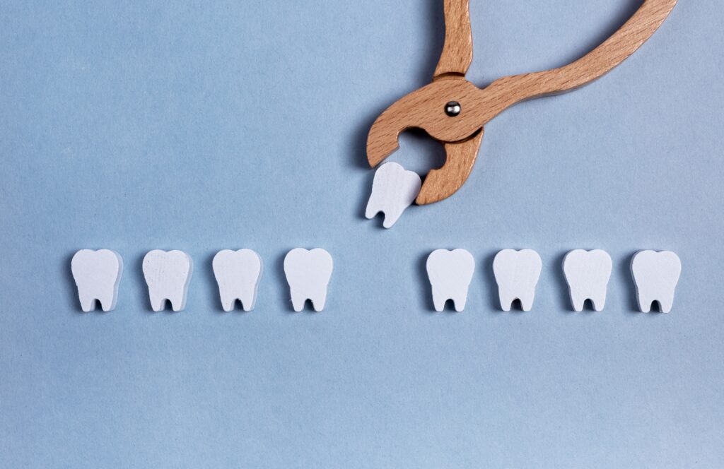 Dental Extractions in Maryville